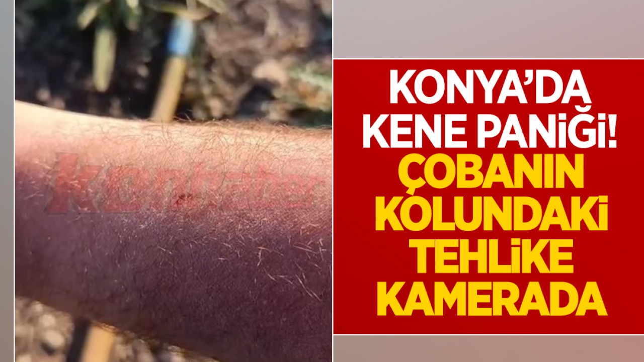 Konya'da kene paniği! Çobanın kolundaki tehlike kamerada