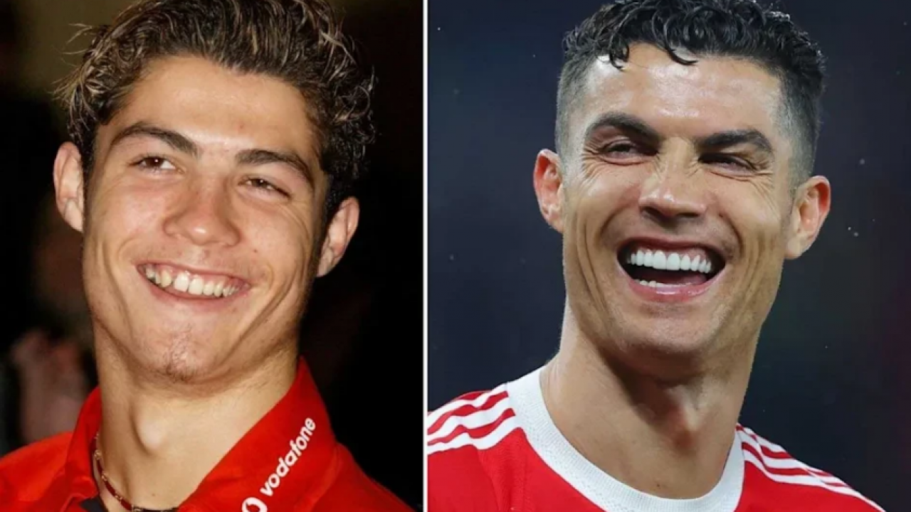 Hollywood Smile ve Gülüş Tasarımı: Işıltılı Bir Gülümsemenin Sırrı