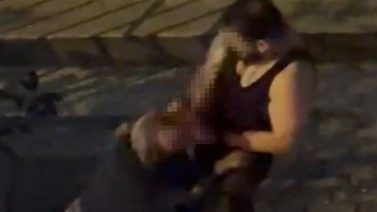 Pitbull cinsi köpek sahibine saldırdı